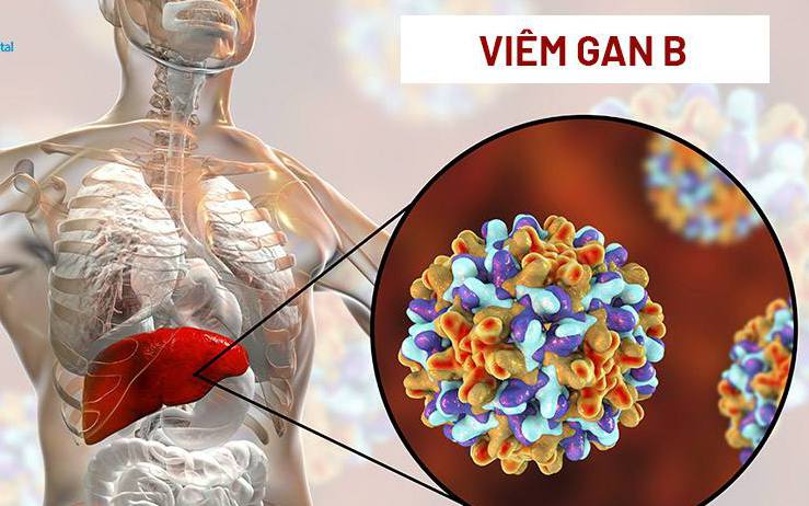 Nhiễm virus viêm gan B sau bao lâu thì xuất hiện triệu chứng và tiến triển thành ung thư gan?
