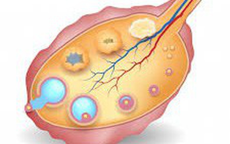 Vi nhựa xâm nhập nang trứng: Báo động mới với khả năng sinh sản nữ- Ảnh 3.