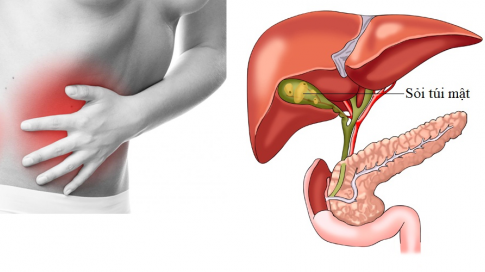 Một số yếu tố làm tăng nguy cơ đầy hơi và cách khắc phục - Ảnh 2.