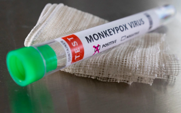 11 dấu hiệu và những cấp độ bệnh đậu mùa khỉ