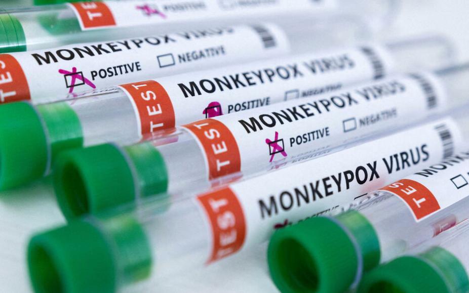 Ủy ban châu Âu ký hợp đồng mua hơn 100.000 liều vaccine ngừa bệnh đậu mùa khỉ