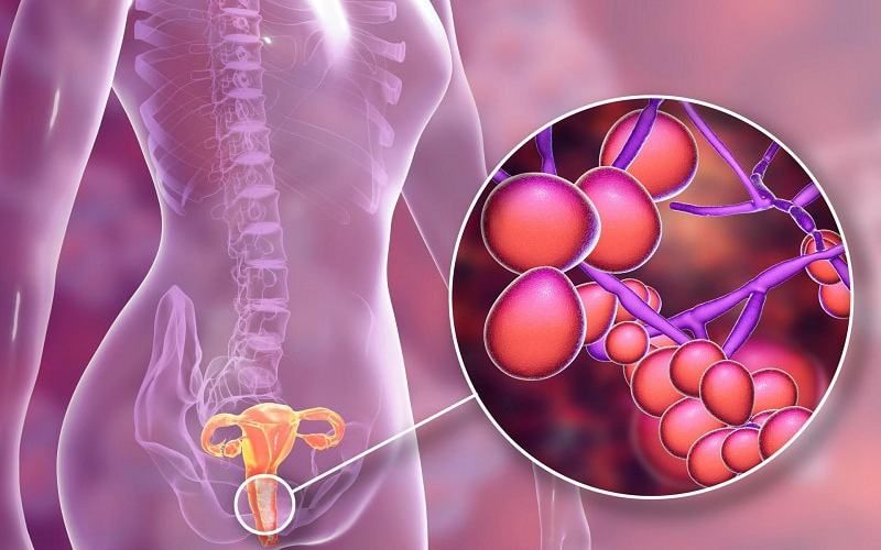 Nam giới có thể lây và lan truyền bệnh viêm âm đạo do vi khuẩn?