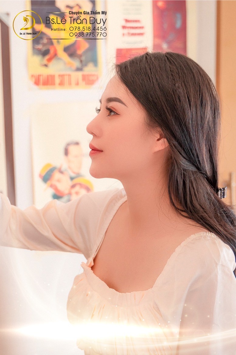 Nâng mũi sụn tự thân tuyệt đẹp ở bác sĩ tài năng - Ảnh 3. Nâng mũi sụn tự thân tuyệt đẹp ở bác sĩ tài năng - Ảnh 3.