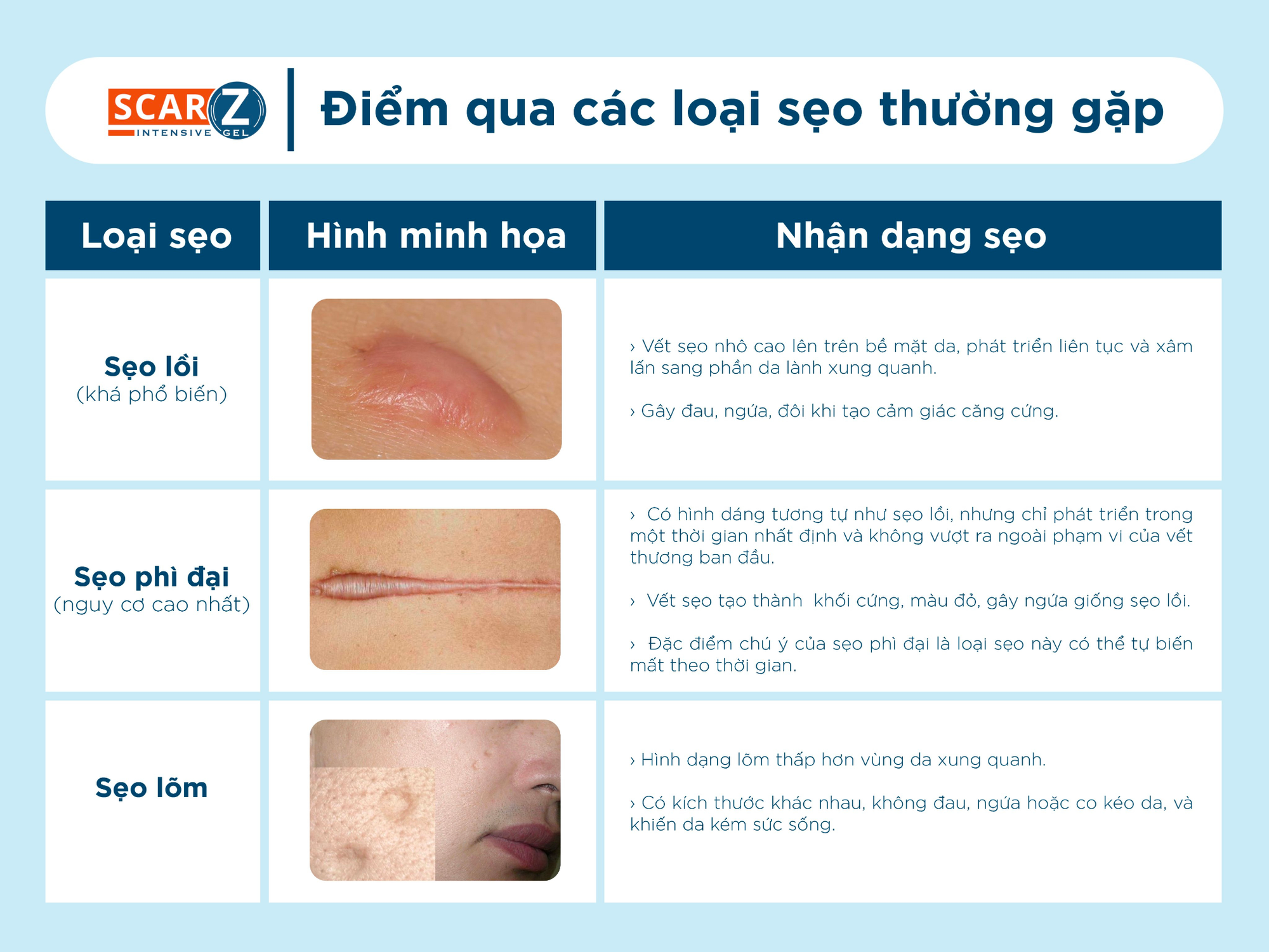 Từ chuyên gia trị sẹo: 4 tuần – 2 lời khuyên giúp lành sẹo hiệu quả - Ảnh 1. Từ chuyên gia trị sẹo: 4 tuần – 2 lời khuyên giúp lành sẹo hiệu quả - Ảnh 1.