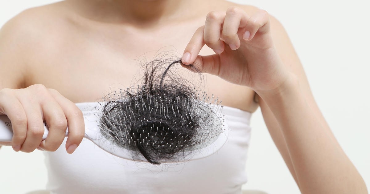 Hạn chế tình trạng rụng tóc ở phụ nữ tuổi trung niên