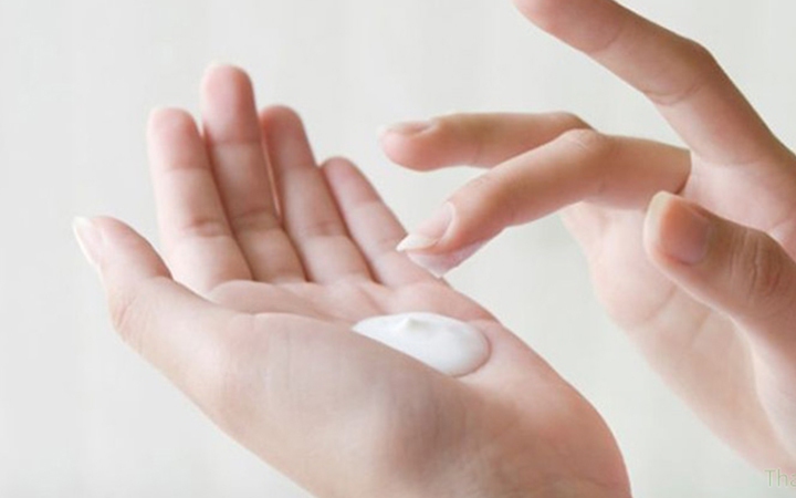 Viêm da tiết bã có lây không?- Ảnh 3.