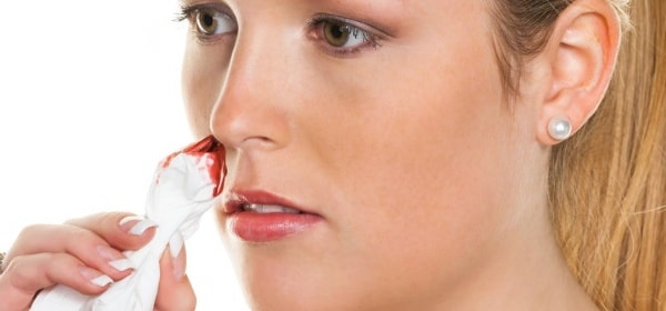 Sơ cứu chảy máu mũi đúng cách từ chuyên gia tai mũi họng - Ảnh 2.