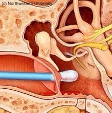 Từ vụ bé 6 tuổi gặp nạn khi được lấy ráy tai, cảnh báo thói quen gây hại tai con nhiều cha mẹ mắc phải - Ảnh 2.