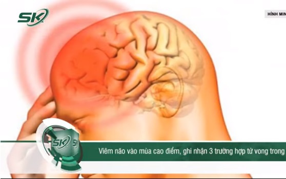 Nhận biết sớm dấu hiệu viêm não nguy hiểm
- Ảnh 2.