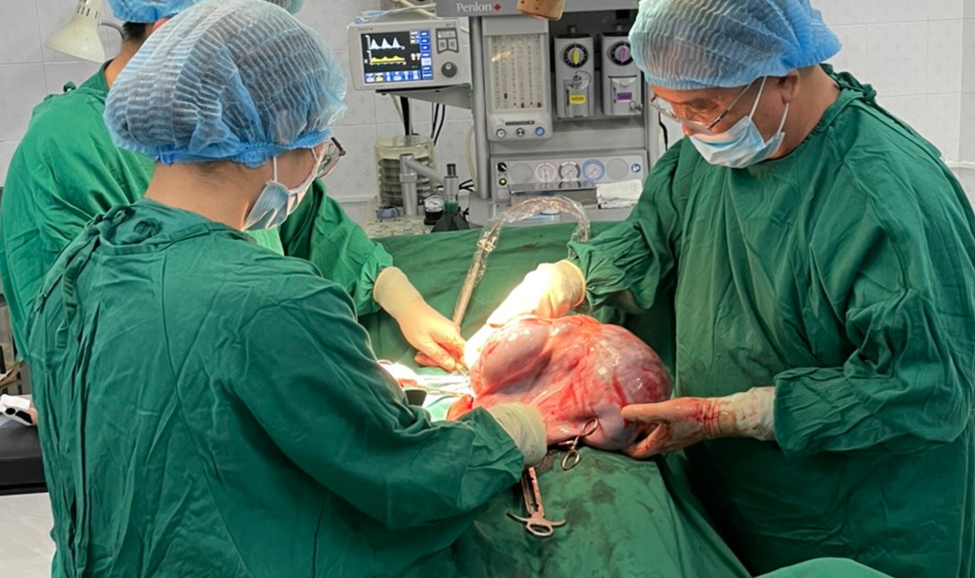 Cắt khối u buồng trứng khổng lồ nặng 10kg giải thoát cho cô gái trẻ

 - Ảnh 2.