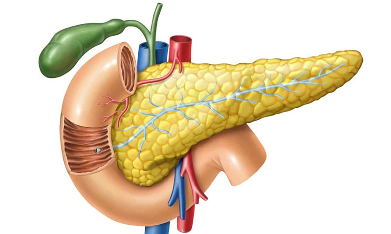 Viêm tụy cấp do đâu, điều trị thế nào để tránh biến chứng và nguy cơ tử vong - Ảnh 3.