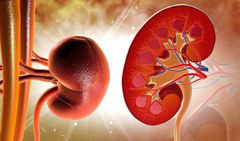 Viêm cầu thận: Nhận biết sớm để tránh biến chứng - Ảnh 1.