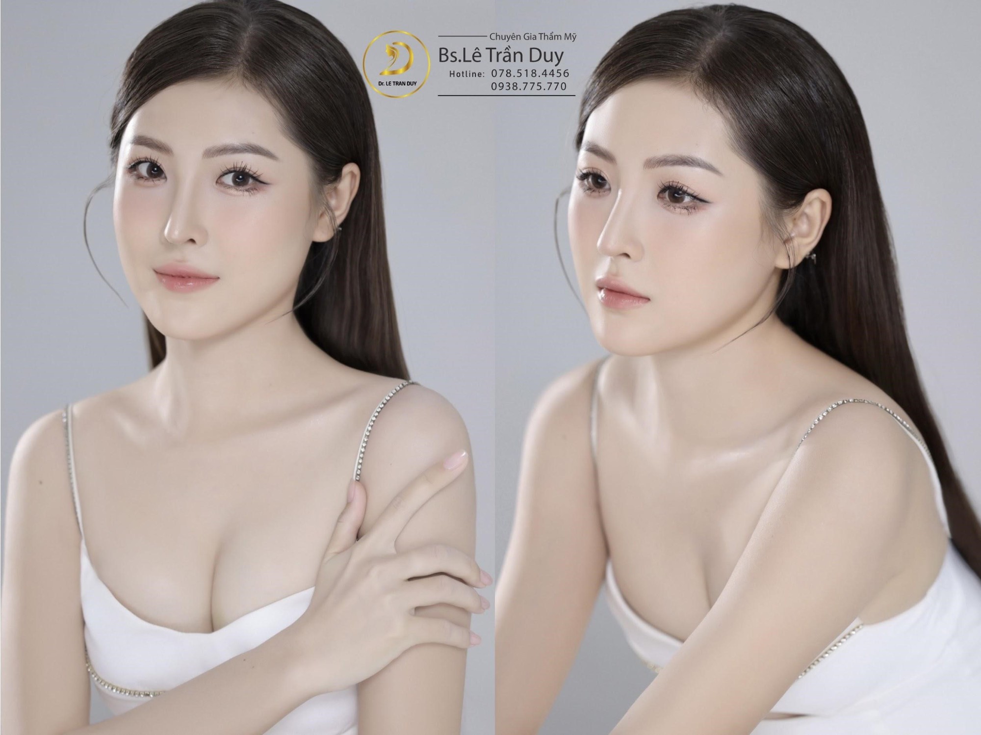 Nọng cằm và cách xoá nọng cằm ở bác sĩ giỏi - Ảnh 2. Nọng cằm và cách xoá nọng cằm ở bác sĩ giỏi - Ảnh 2.