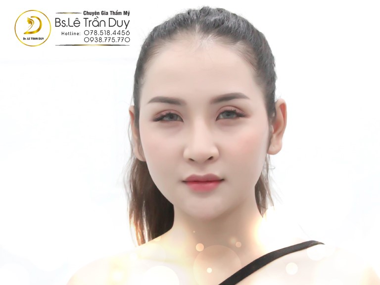 Nọng cằm và cách xoá nọng cằm ở bác sĩ giỏi - Ảnh 3. Nọng cằm và cách xoá nọng cằm ở bác sĩ giỏi - Ảnh 3.