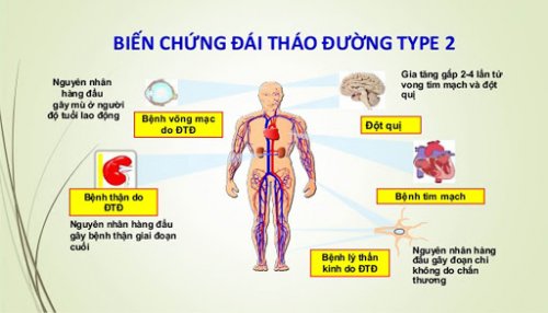 Nghiên cứu mới: Châm cứu có thể làm giảm nguy cơ mắc tiểu đường typ 2 - Ảnh 2.