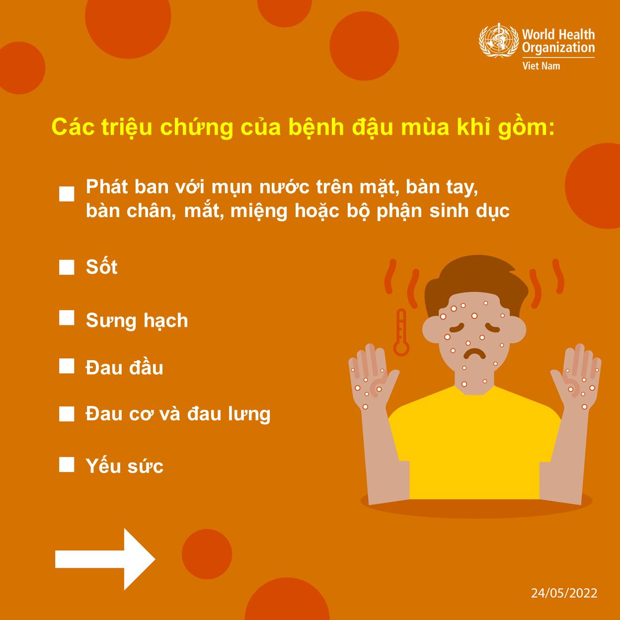 [Infographic] - Những điều cần biết về bệnh đậu mùa khỉ - Ảnh 3.