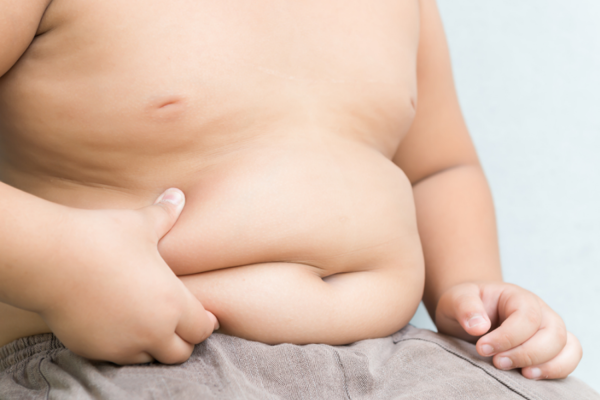 Hậu quả của béo phì và thừa cân ở trẻ em - Ảnh 2.