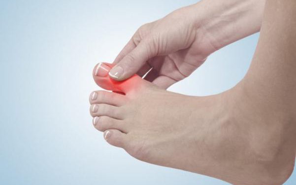Dấu hiệu bệnh gút ở chân và cách hỗ trợ giảm đau tại nhà