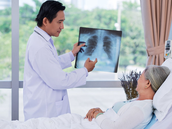 Phổi được chia thành nhiều phân thùy giúp xác định vị trí tổn thương chính xác hơn