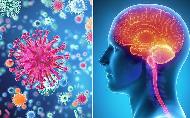Viêm màng não mủ cần phân biệt với các loại bệnh nào?