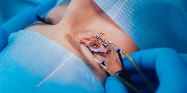 Mổ mắt cận thị có được hưởng bảo hiểm y tế không?