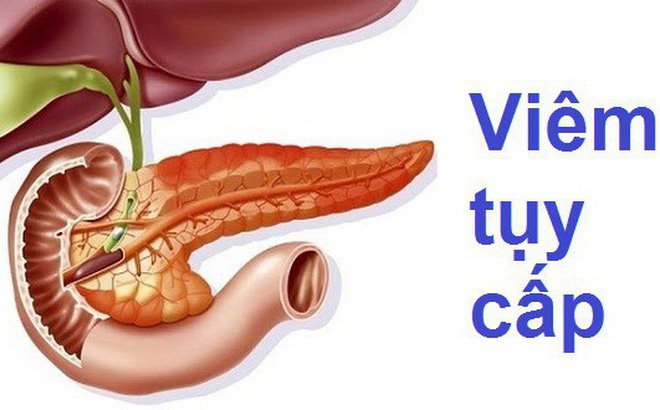 4. Triệu chứng và chẩn đoán viêm tụy cấp