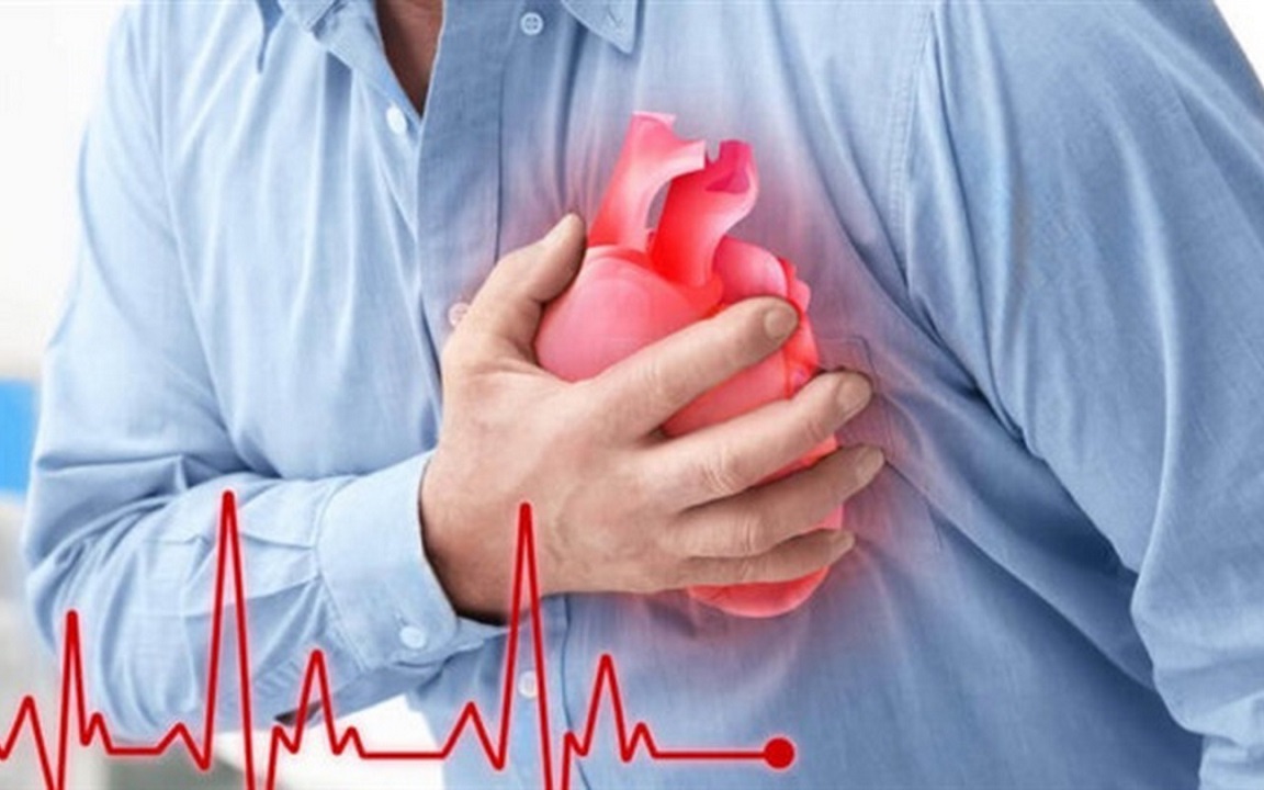 Cứu sống trường hợp ngừng tuần hoàn do nhồi máu cơ tim với nguy cơ tử vong 99%