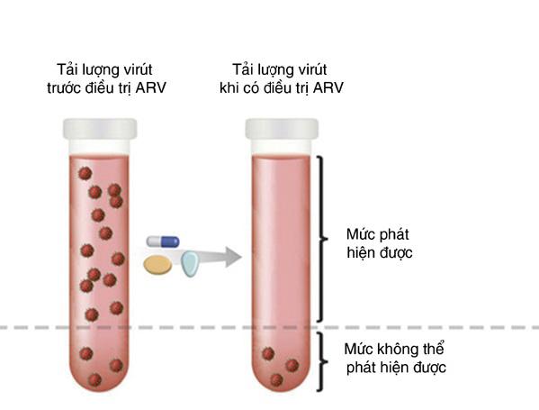 Tải Lượng Virus HIV Bao Nhiêu Là Cao? Cách Đọc Và Hiểu Kết Quả Xét Nghiệm