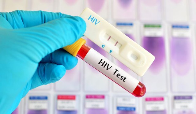 Tăng cường trang bị nhận thức K=K trong điều trị HIV ở Khánh Hòa- Ảnh 3.