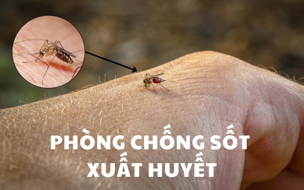 Cảnh báo dịch sốt xuất huyết bùng phát tại thời điểm giao mùa