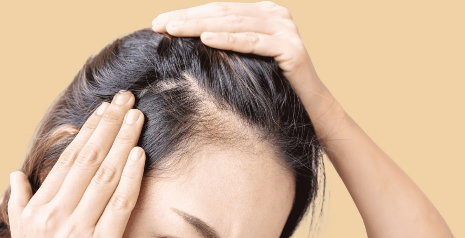 4 phương pháp cải thiện rụng tóc ở nam giới - VnExpress Sức khỏe