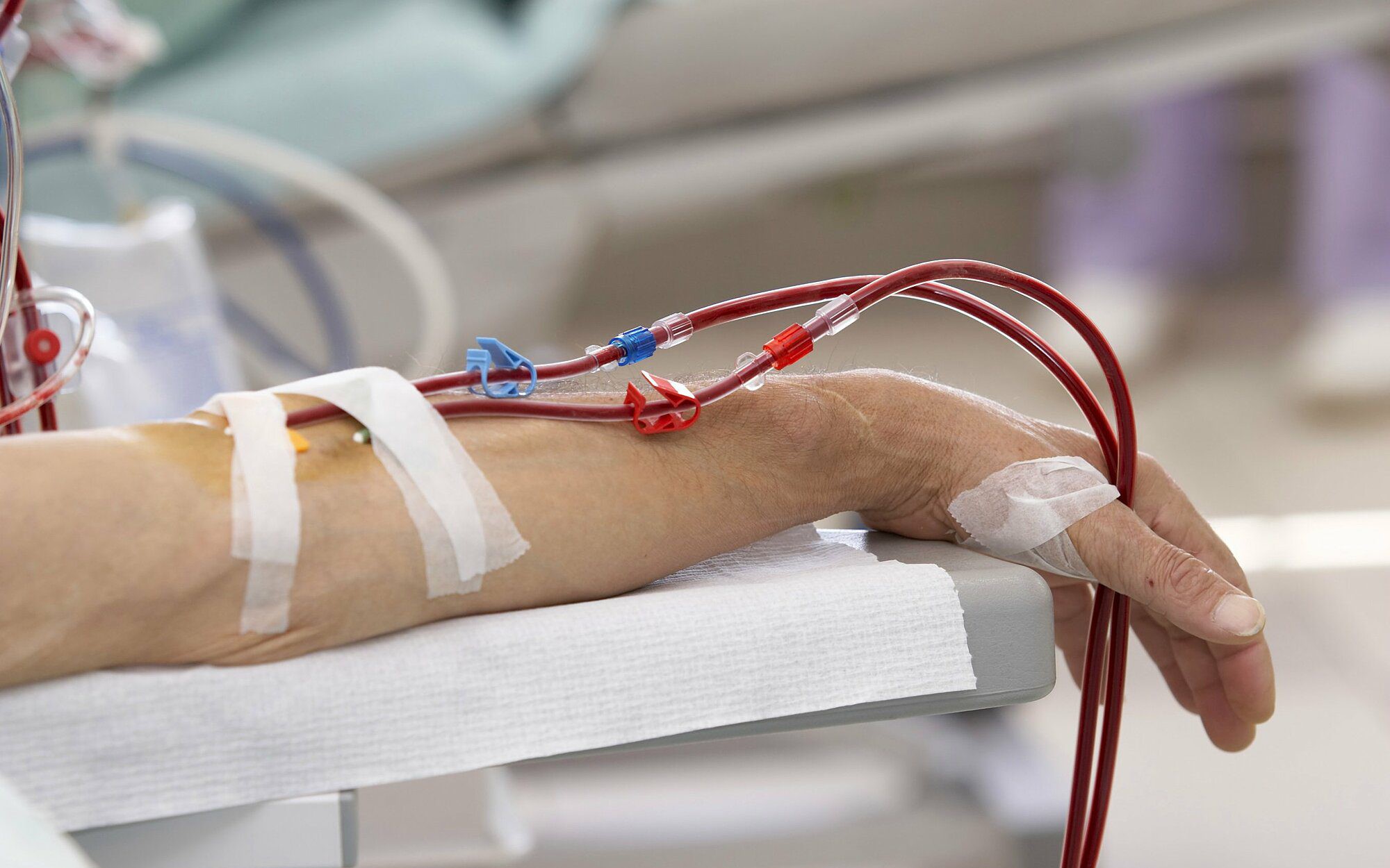 Nâng cao chuyên môn hiệu chỉnh liều thuốc trên bệnh nhân lọc máu