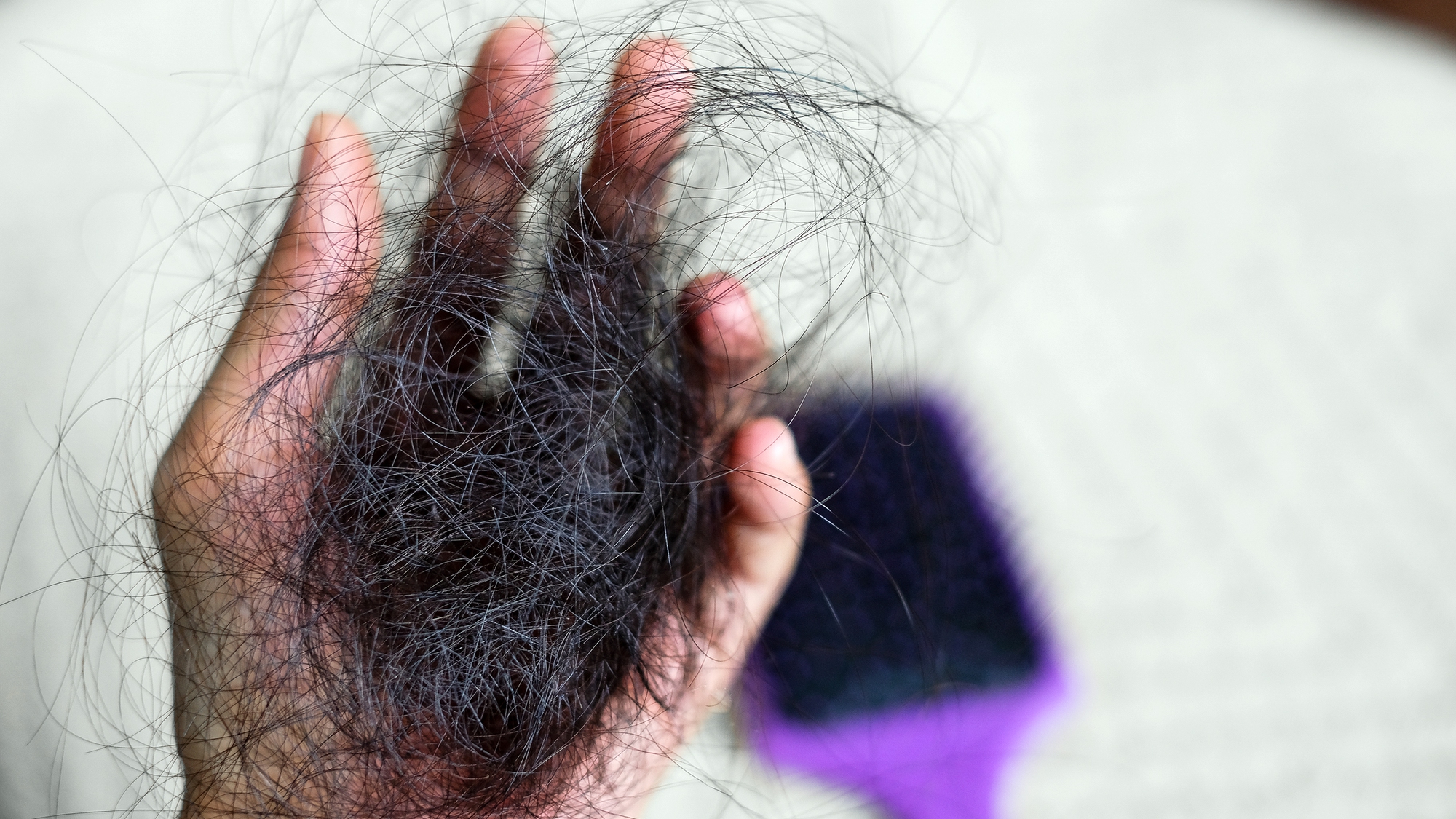 TOP 25 dầu gội trị rụng tóc và kích thích mọc tóc bác sĩ khuyên dùng