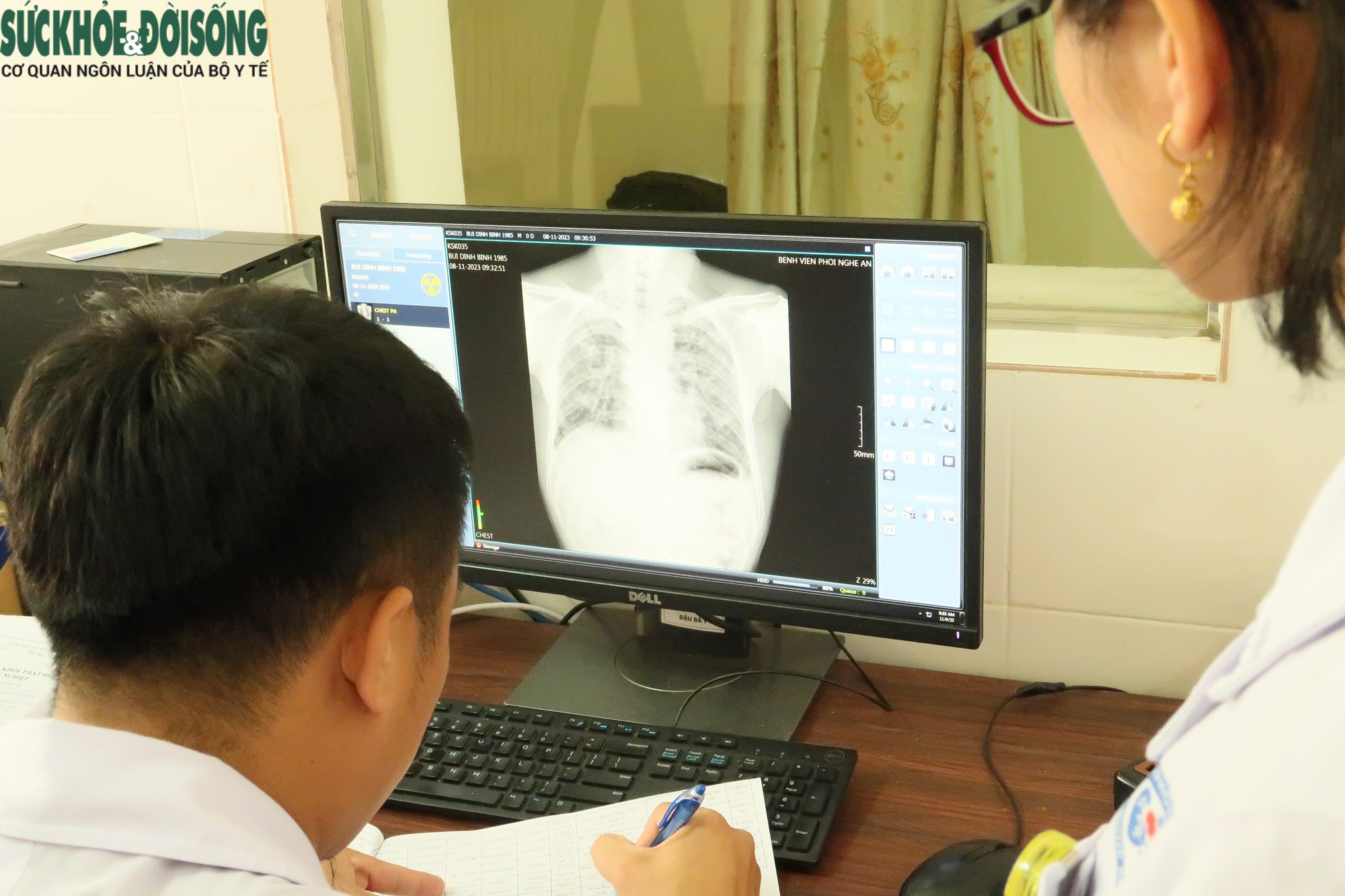 Hàng chục công nhân mắc bệnh bụi phổi ở Nghệ An: Sống trong nghèo khó và nỗi lo bệnh tật- Ảnh 3.