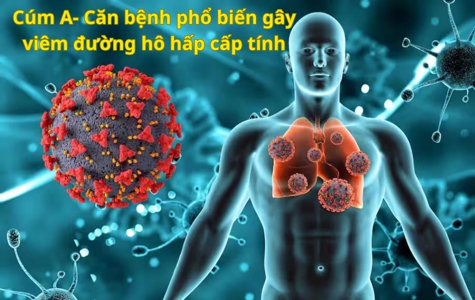 Triệu chứng nhiễm cúm A/H5N1 và các giai đoạn tiến triển của bệnh- Ảnh 2.