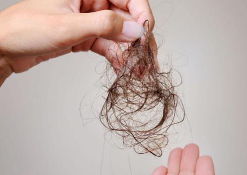Mách bạn 7 cách trị rụng tóc nam hiệu quả tại nhà