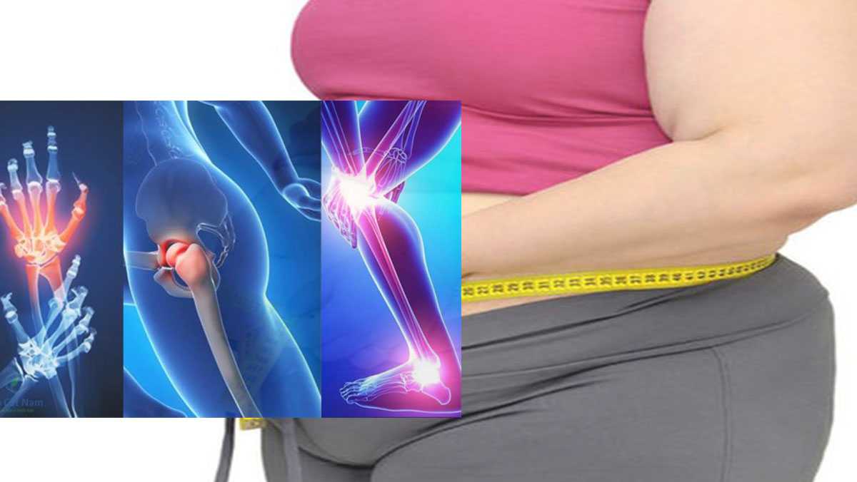 Người béo phì bị thoái hóa khớp giảm cân thế nào?