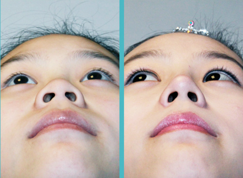 3 cách làm mũi nhỏ lại giúp gương mặt thêm phần thanh tú, sắc sảo tự nhiên