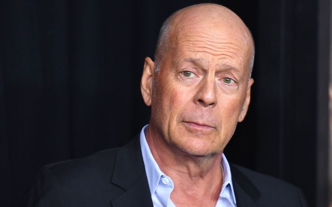 Chứng sa sút trí tuệ mà tài tử Hollywood Bruce Willis mắc phải nguy hiểm thế nào?