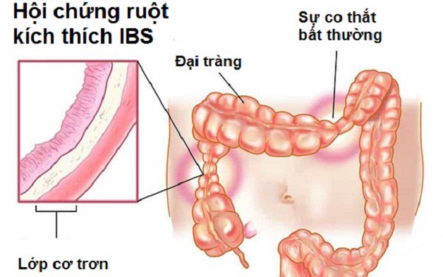 Các thuốc dùng trị hội chứng ruột kích thích kèm táo bón