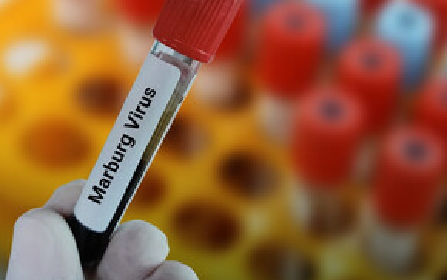 TP.HCM nâng cao cảnh giác với bệnh do virus Marburg