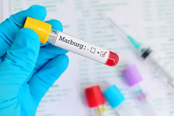 Virus Marburg không dễ lây như COVID – 19 nhưng đặc biệt nguy hiểm - Ảnh 1.