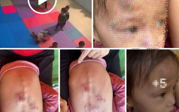 Vụ bé trai 17 tháng tuổi tử vong sau khi đi lớp: Tạm giữ hai cô giáo
