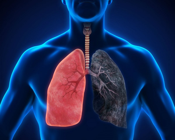 Các tác dụng phụ thường gặp khi điều trị ung thư phổi - Ảnh 1.