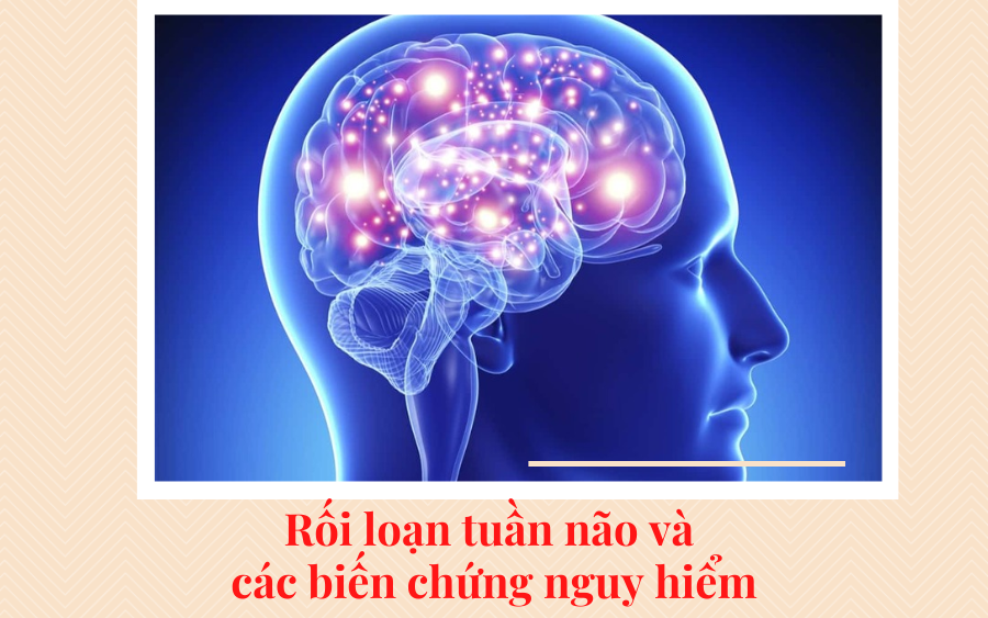 Rối loạn tuần hoàn não và những biến chứng nguy hiểm