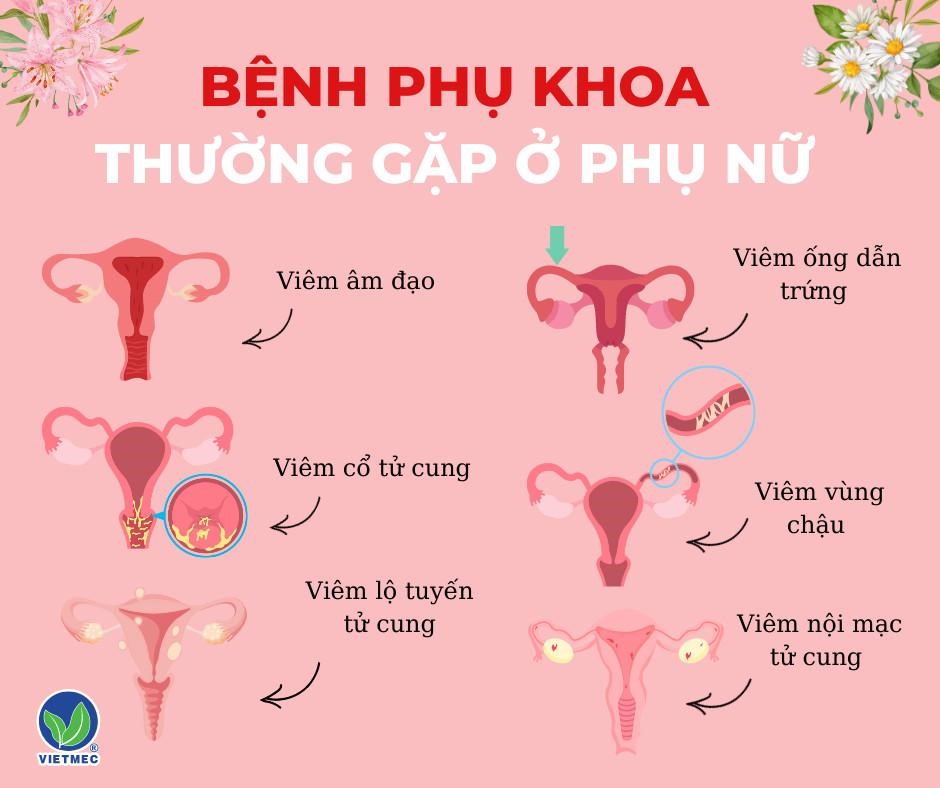 Viên đặt Phụ Khoa Thảo Dược Có Gì Mà Mọi Chị Em đều Yêu Thích 6057