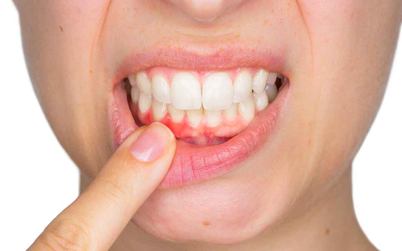Tụt lợi do nguyên nhân nào và những hậu quả mà nhiều người không biết
