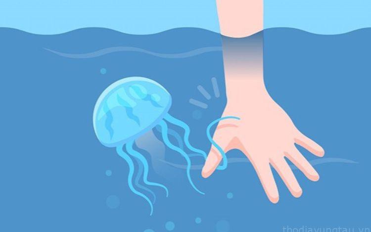 Cách cấp cứu khi đi biển bị sứa 'cắn'