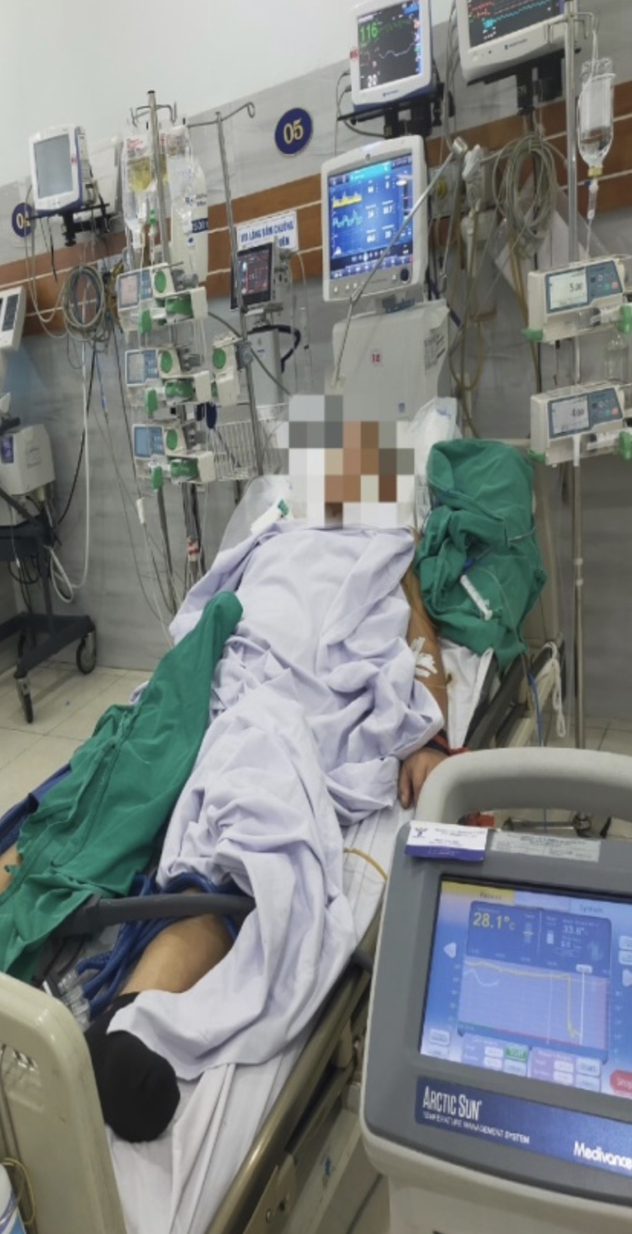 Bệnh nhân 77 tuổi ngừng tuần hoàn trong 2 giờ đã thoát chết nhờ kỹ thuật hạ thân nhiệt chỉ huy  - Ảnh 1.