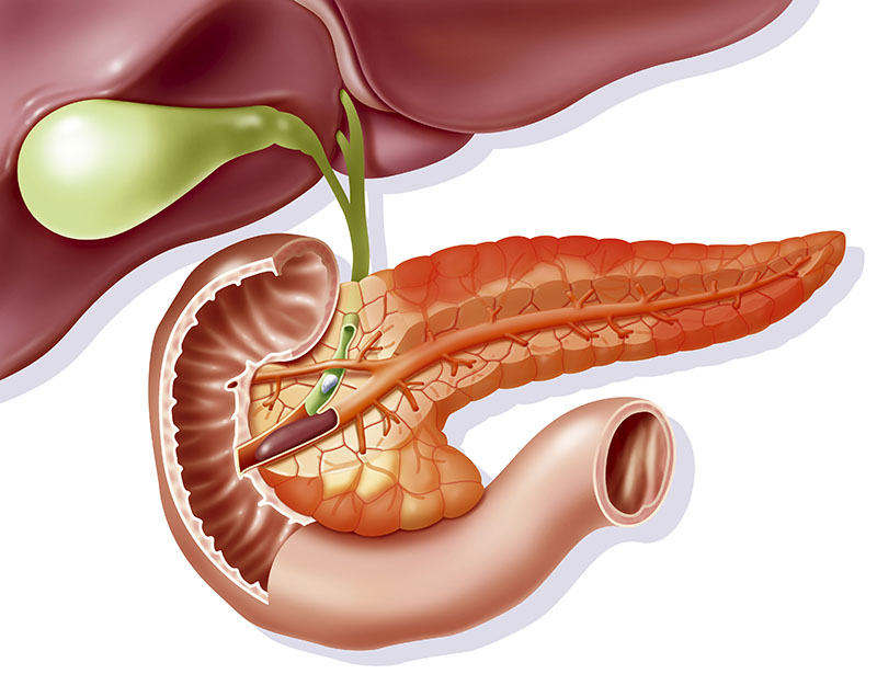 5 loại thuốc có thể là thủ phạm gây viêm tuỵ cấp